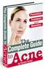 Thumbnail The Complete Guide to Acne Prevention Treatment   and Remed