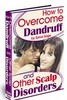 Thumbnail How To Overcome Dandruff
